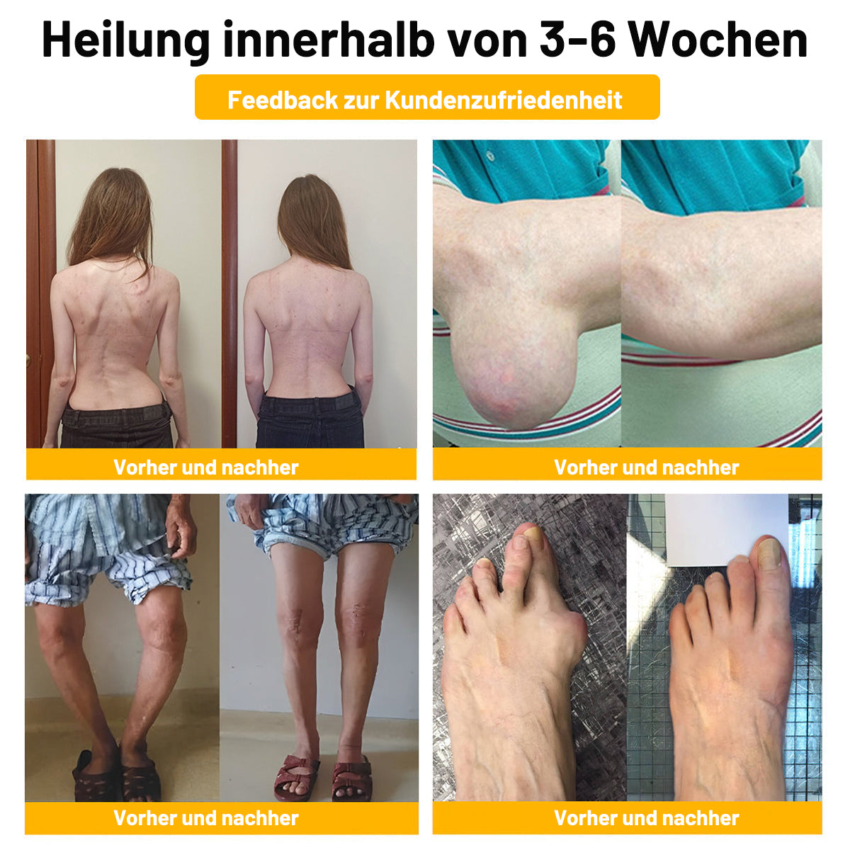 ⚡ Flash Sale: 𝗧𝗟𝗢𝗣𝗔® Upgrade nu naar het VIP-kortingsplan voor gewrichtspijnverlichting - 50% korting ⏳ (slechts 72 uur!) ✨