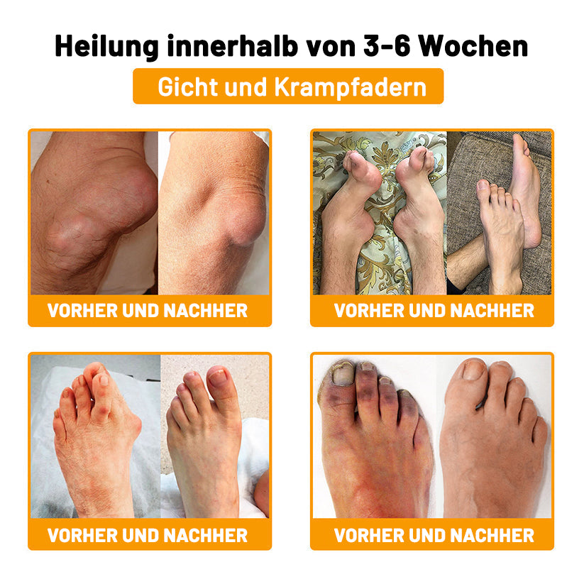 ⚡ Flash Sale: 𝗧𝗟𝗢𝗣𝗔® Upgrade nu naar het VIP-kortingsplan voor gewrichtspijnverlichting - 50% korting ⏳ (slechts 72 uur!) ✨