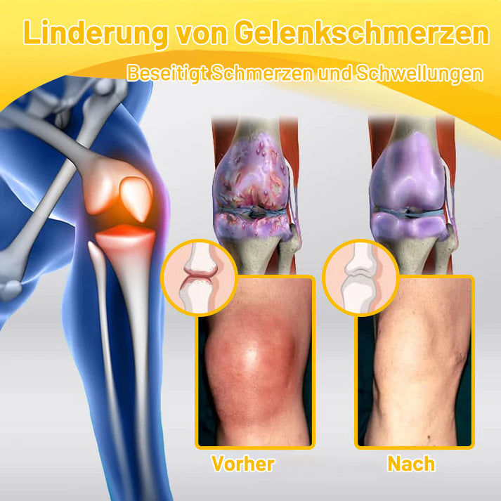 ⚡ Flash Sale: 𝗧𝗟𝗢𝗣𝗔® Upgrade nu naar het VIP-kortingsplan voor gewrichtspijnverlichting - 50% korting ⏳ (slechts 72 uur!) ✨