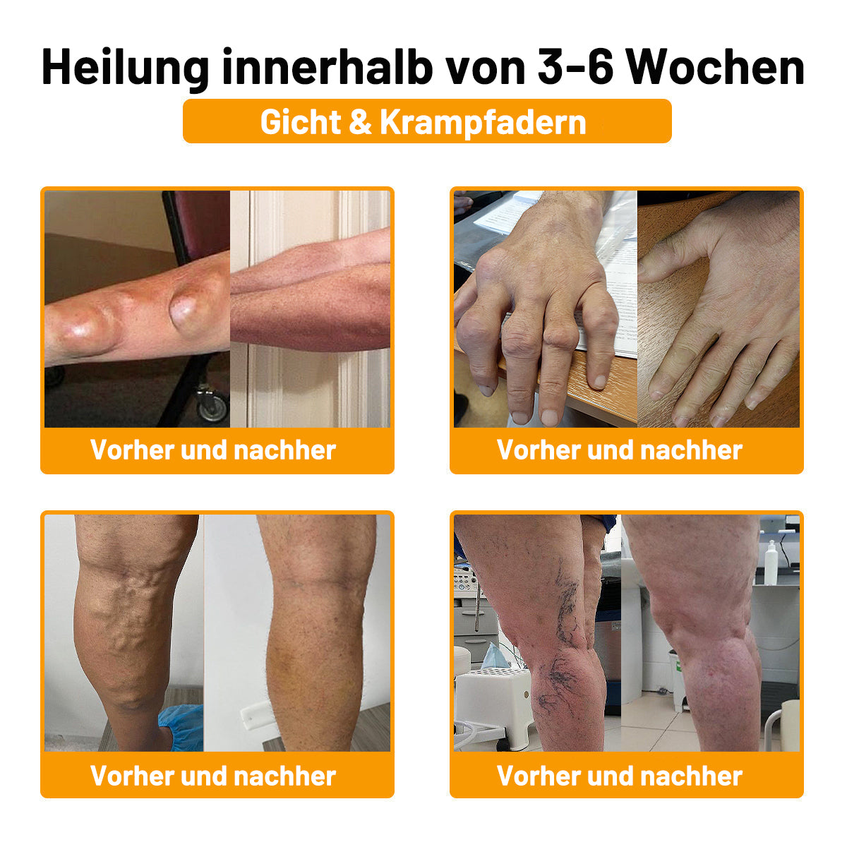 ⚡ Flash Sale: 𝗧𝗟𝗢𝗣𝗔® Upgrade nu naar het VIP-kortingsplan voor gewrichtspijnverlichting - 50% korting ⏳ (slechts 72 uur!) ✨